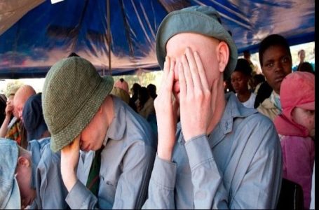 6 choses à savoir sur le meurtre rituel des albinos dans certaines régions d’Afrique