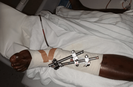 Allemagne: menacé d’expulsion, un immigré sénégalais saute d’un immeuble