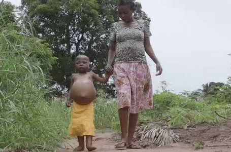 RDC : une fillette de 6 ans meurt de faim après avoir mangé du sable