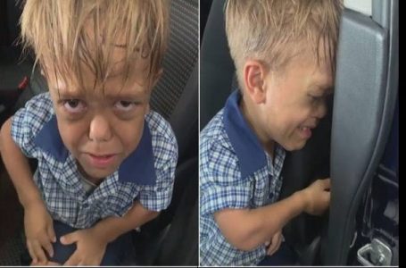 Harcelé à l’école, cet enfant atteint de nanisme dit à sa mère qu’il veut se suicider…La vidéo choque la toile