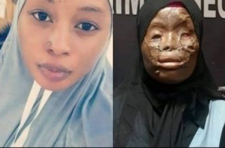 Comment une jolie Ghanéenne a été arrosée d’acide en Arabie saoudite