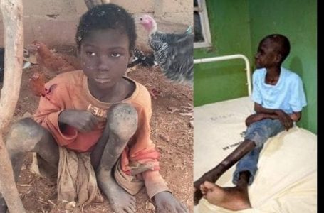 Nigeria : un garçon épileptique de 10 ans enchaîné par ses parents depuis 2 ans enfin secouru (vidéo)