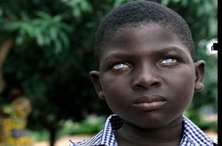 Voici la vérité derrière les yeux bleus de certains Africains