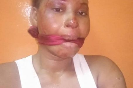 Burkina Faso : une artiste agressée et violée à son domicile par des individus aux visages cagoulés – (photos)