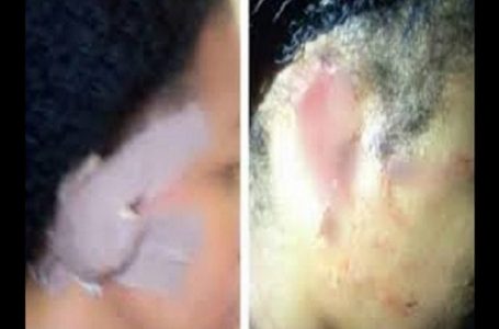 Nigeria: un époux mord et arrache l’oreille de sa femme