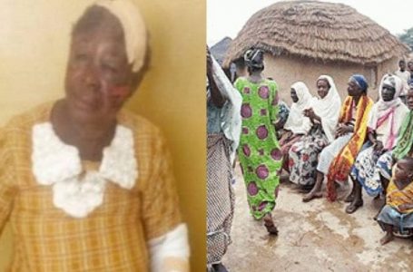 Ghana : une vieille femme accusée d’être une sorcière battue sévèrement par des villageois
